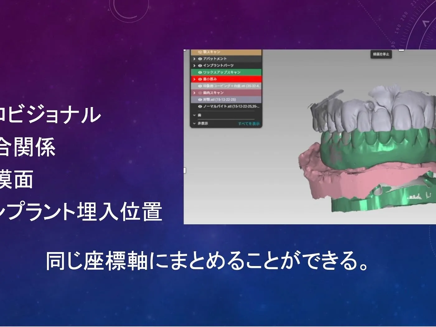 🦷デンタルコンセプト21 北日本支部会 in 秋田