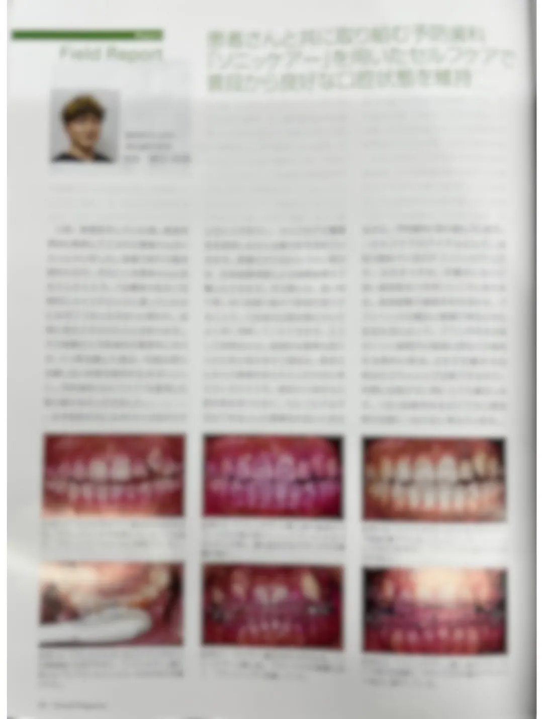 【予防歯科🦷】