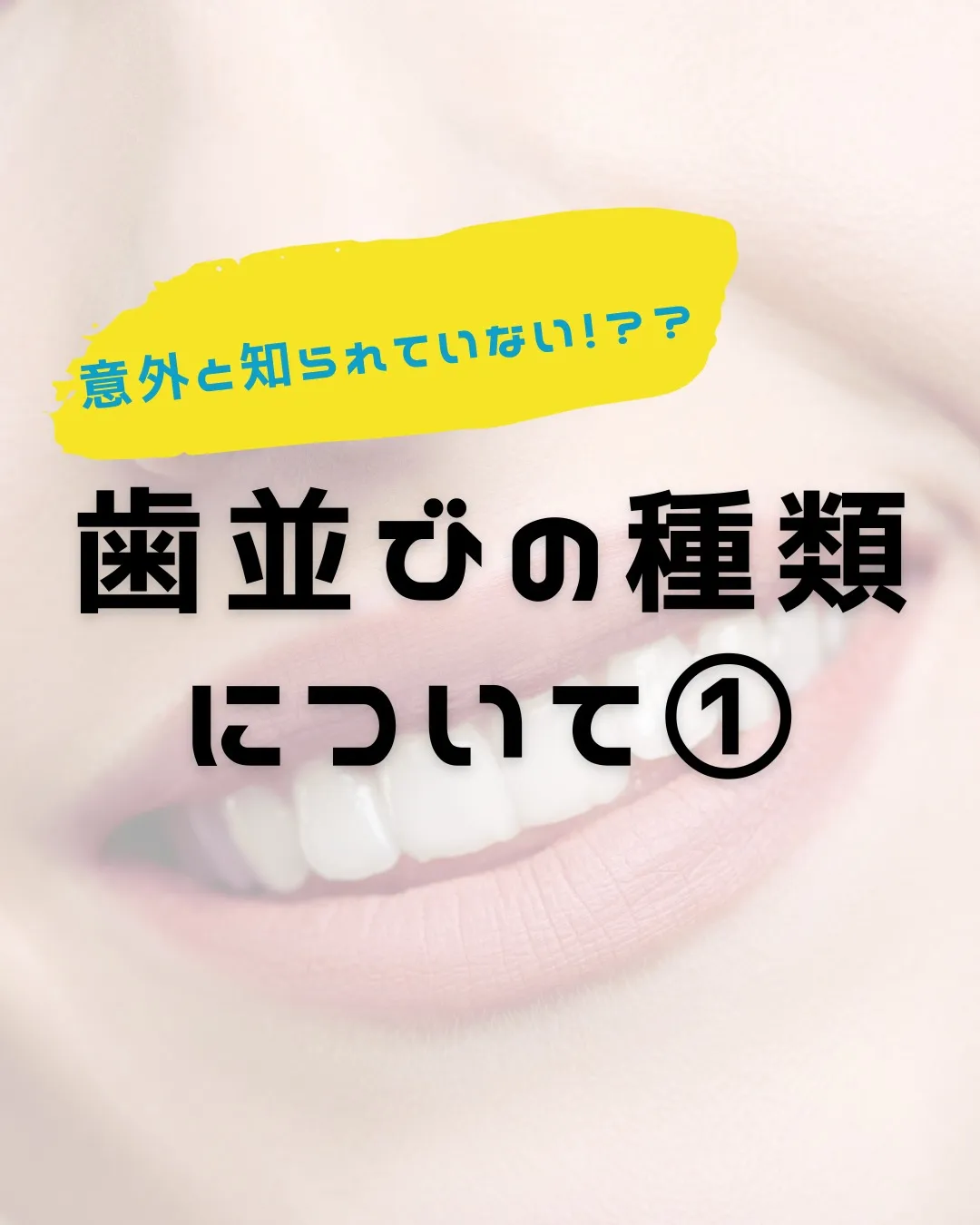 【意外と知らない！？歯並びの種類と原因①】