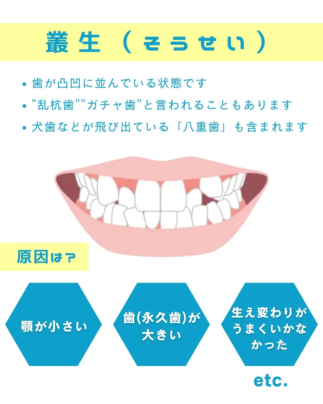 【意外と知らない！？歯並びの種類と原因①】