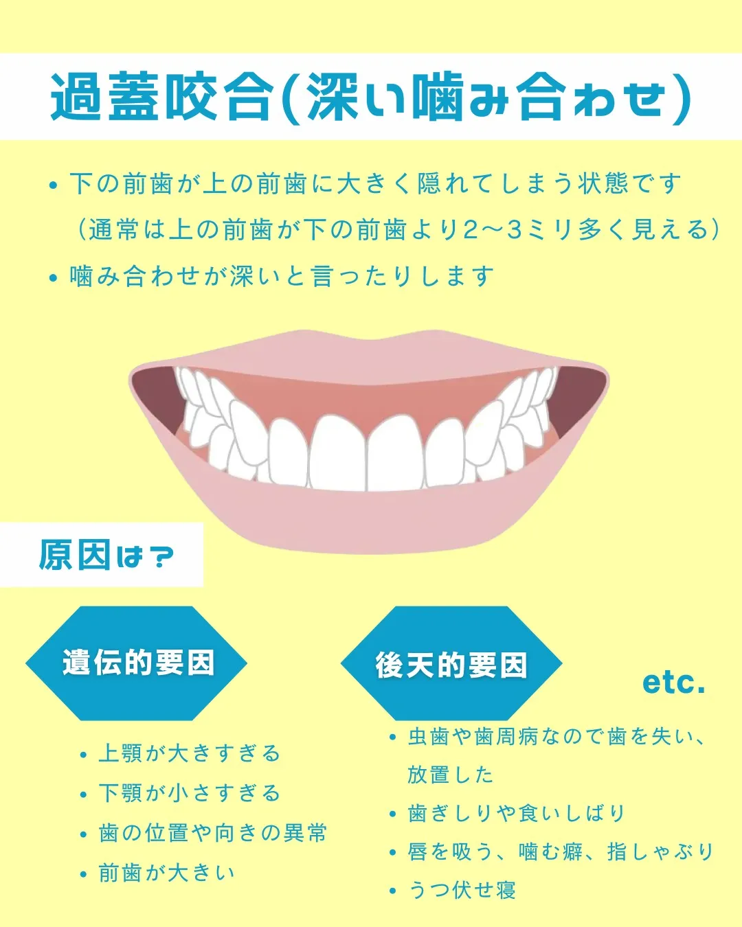【意外と知らない！？歯並びの種類と原因①】