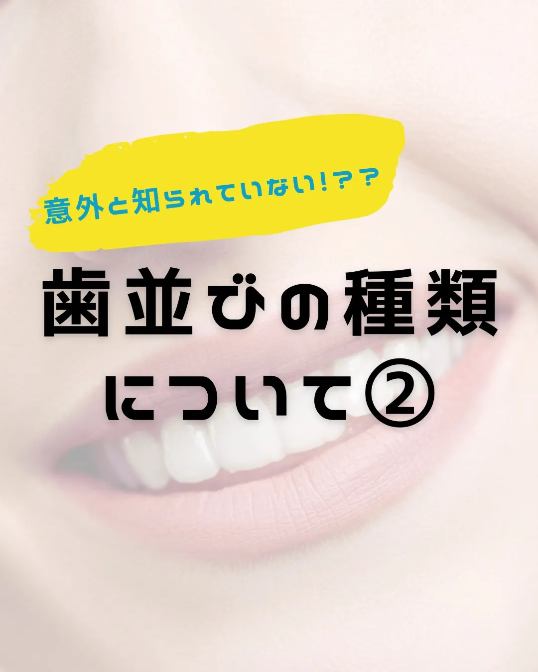 【意外と知らない！？歯並びの種類と原因②】