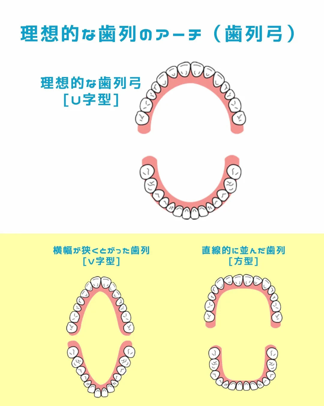 【意外と知らない！？歯並びの種類と原因②】