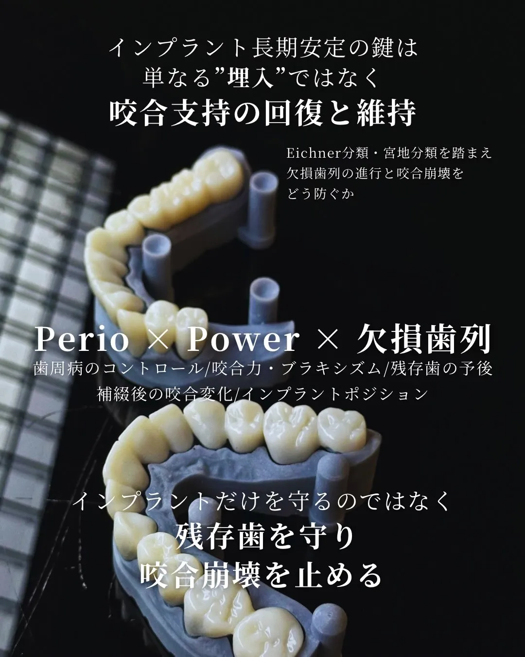 【インプラント治療の「長期安定」を考える】