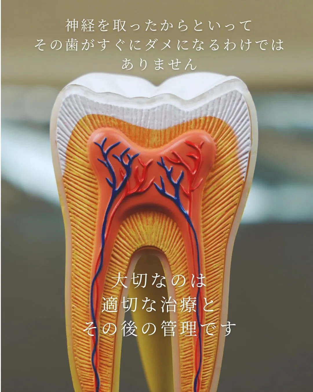【神経を取った歯は危険⚠️?】