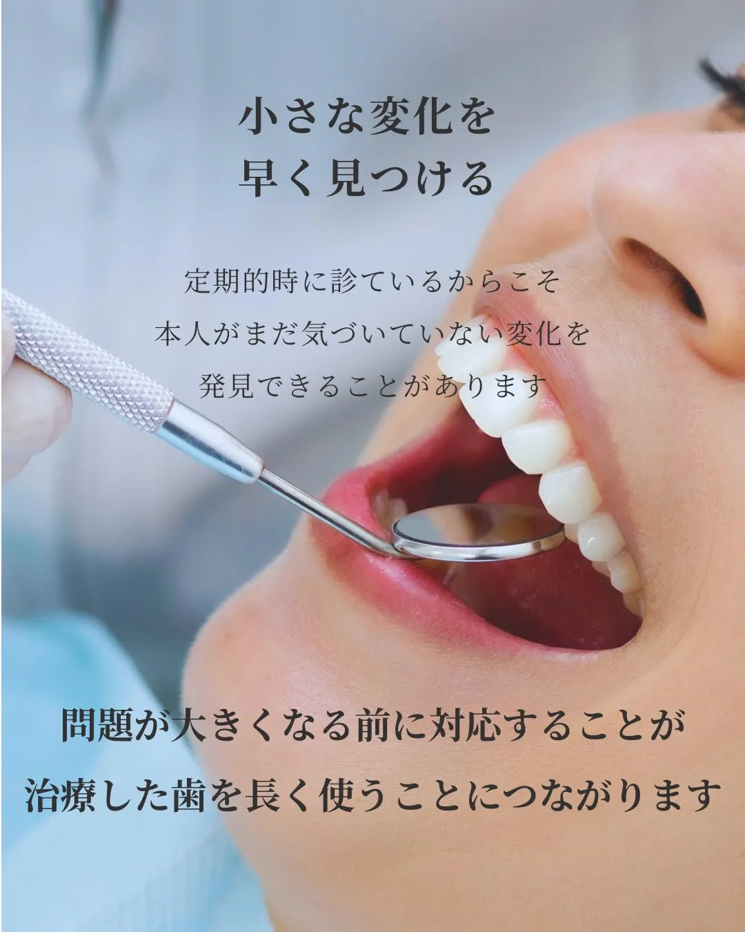 【神経を取った歯は危険⚠️?】