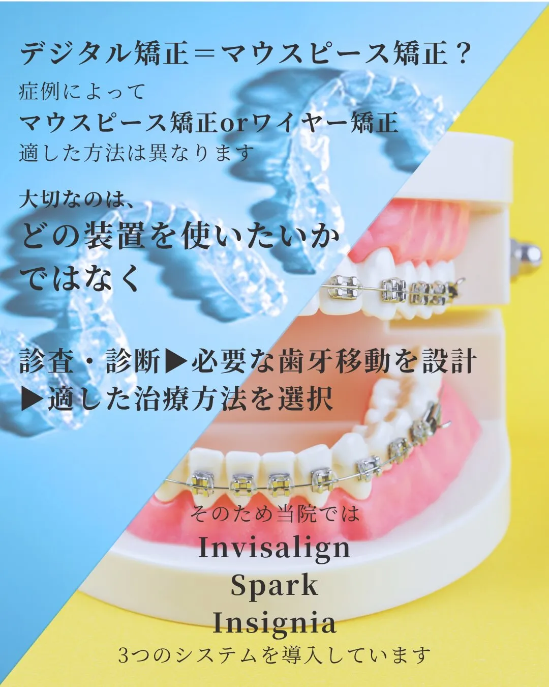 デジタル矯正ってなに??🦷