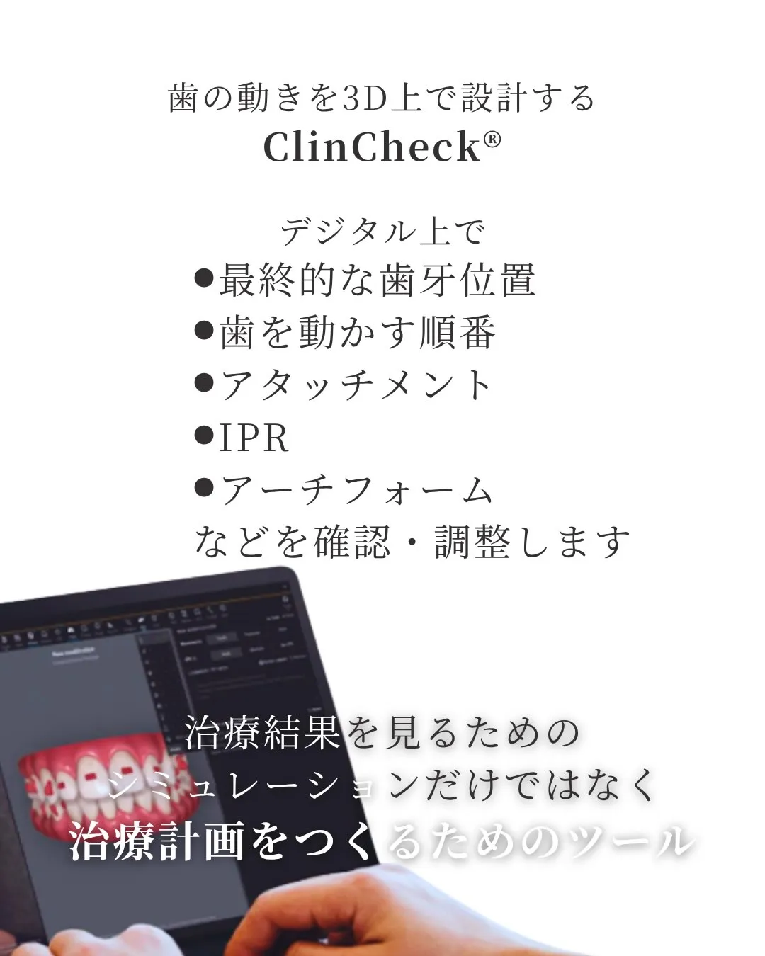 🦷【デジタル矯正|Invisalign編】