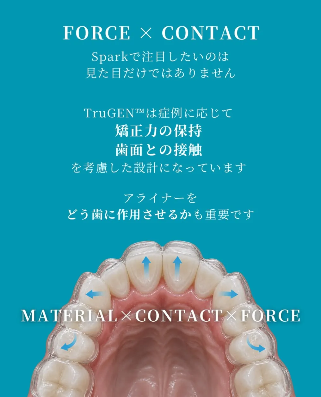 🦷【デジタル矯正｜Spark編】
