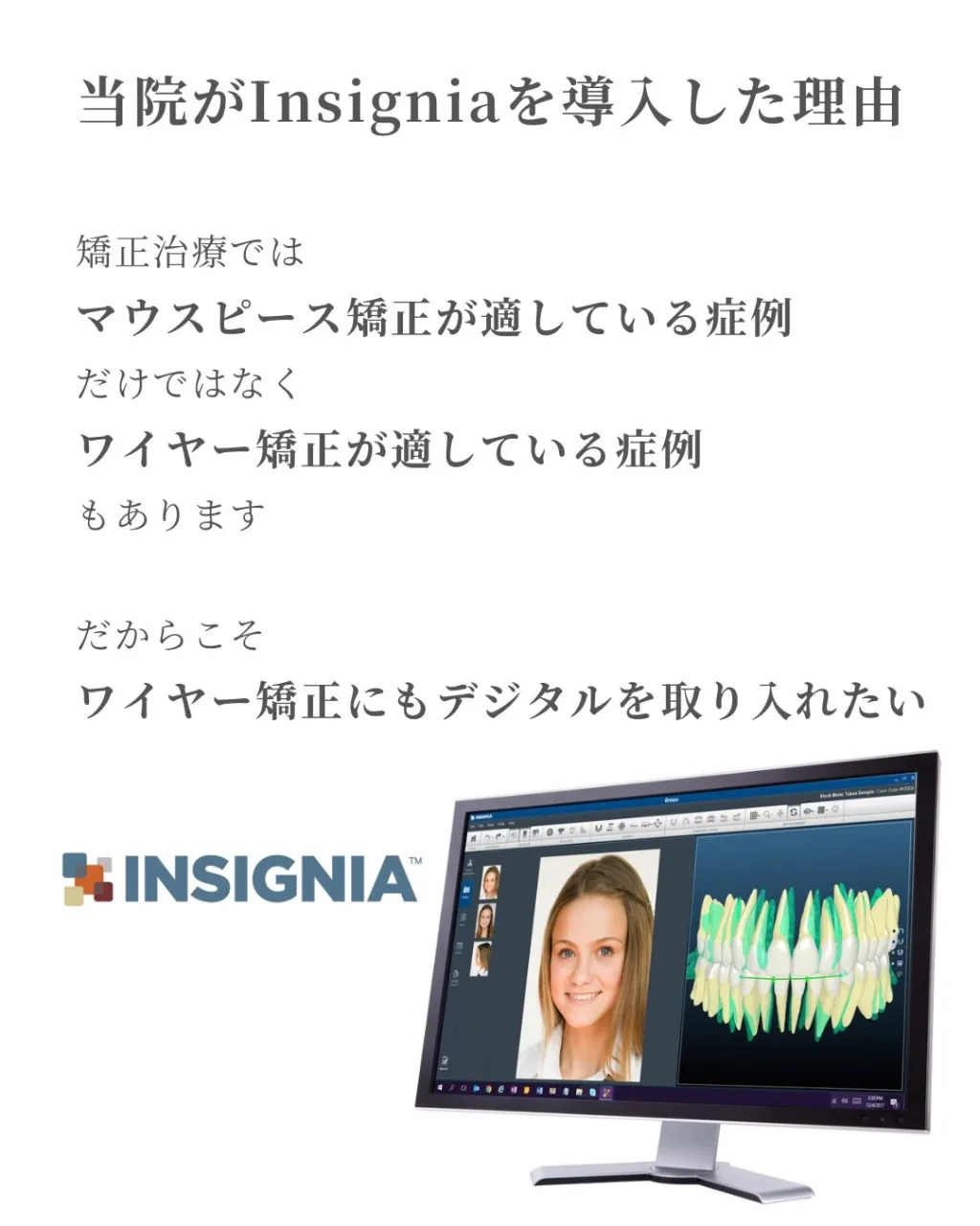 🦷【デジタル矯正|Insignia編】