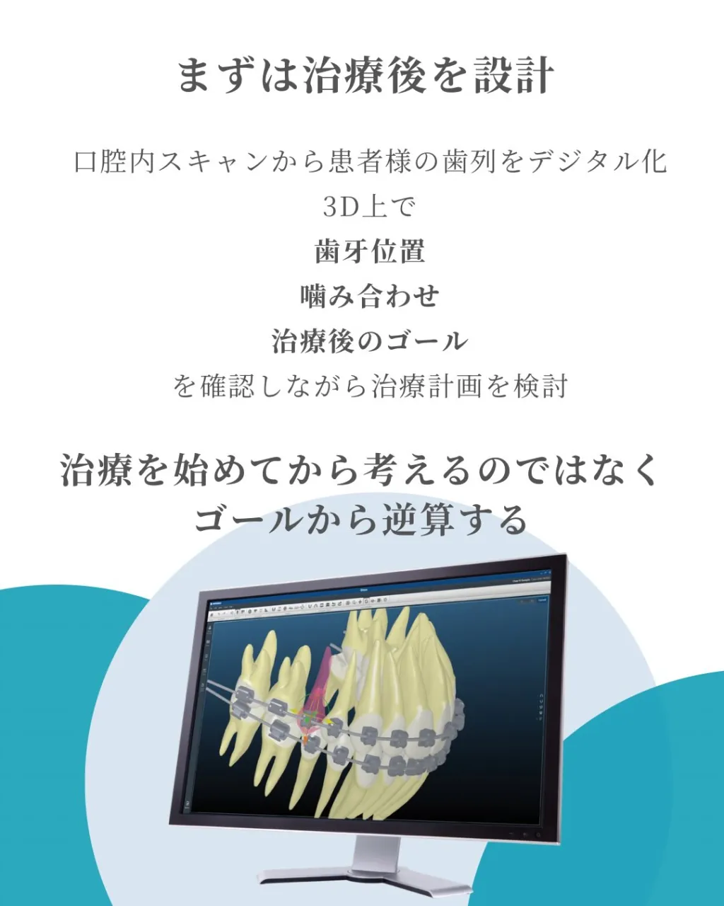 🦷【デジタル矯正|Insignia編】