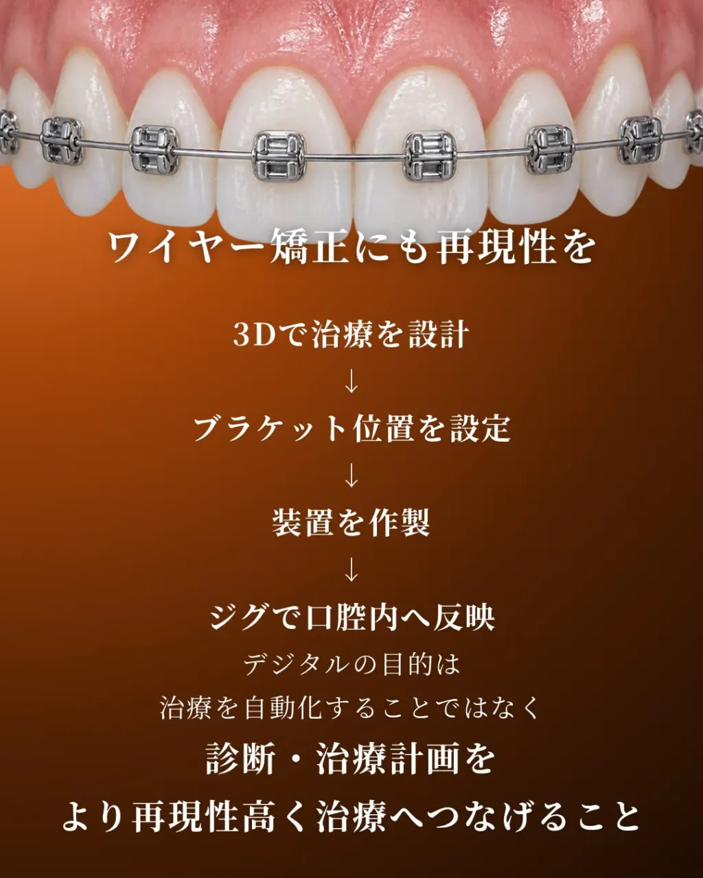 🦷【デジタル矯正|Insignia編】