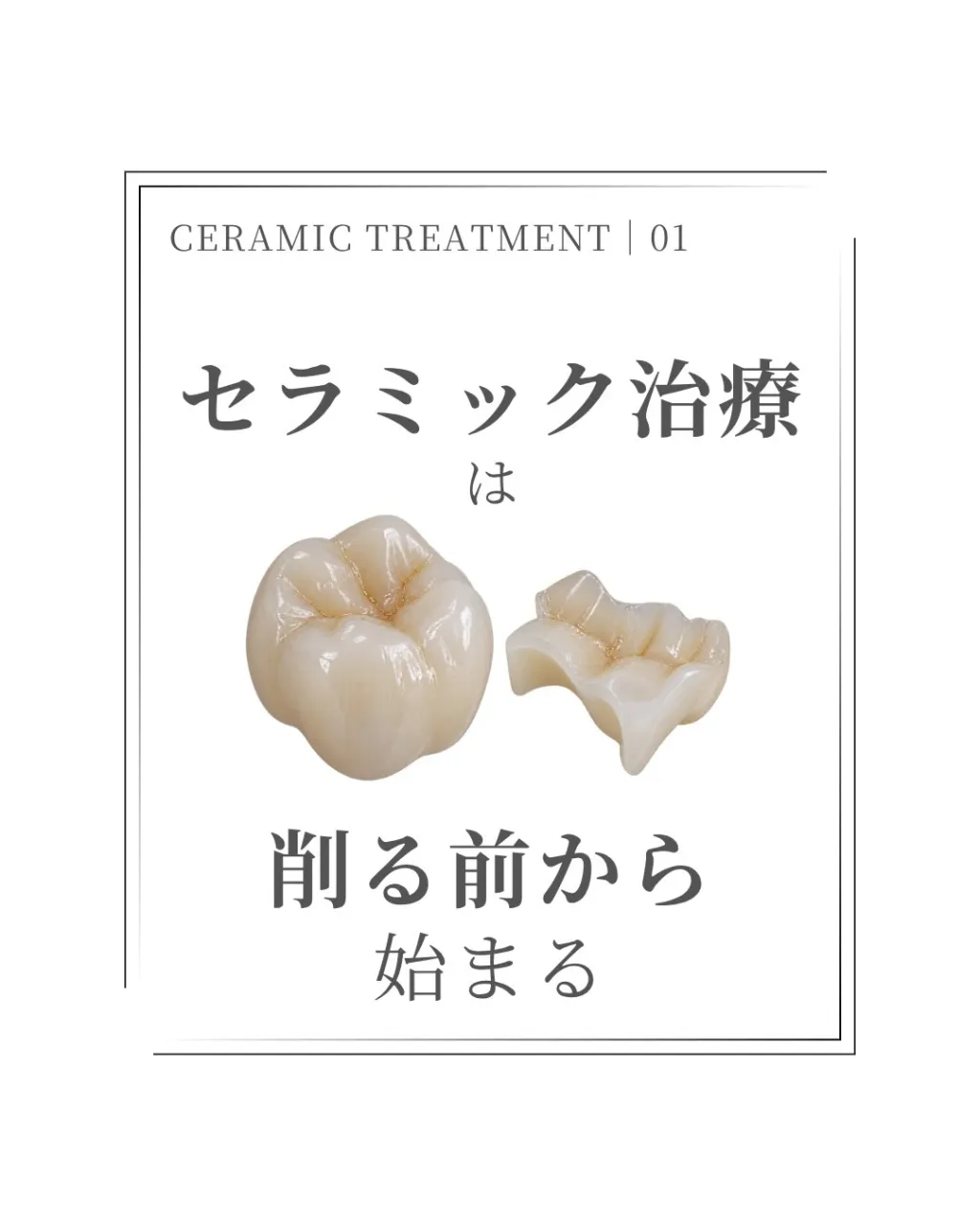 🦷【セラミック治療は「削る前」から始まります】