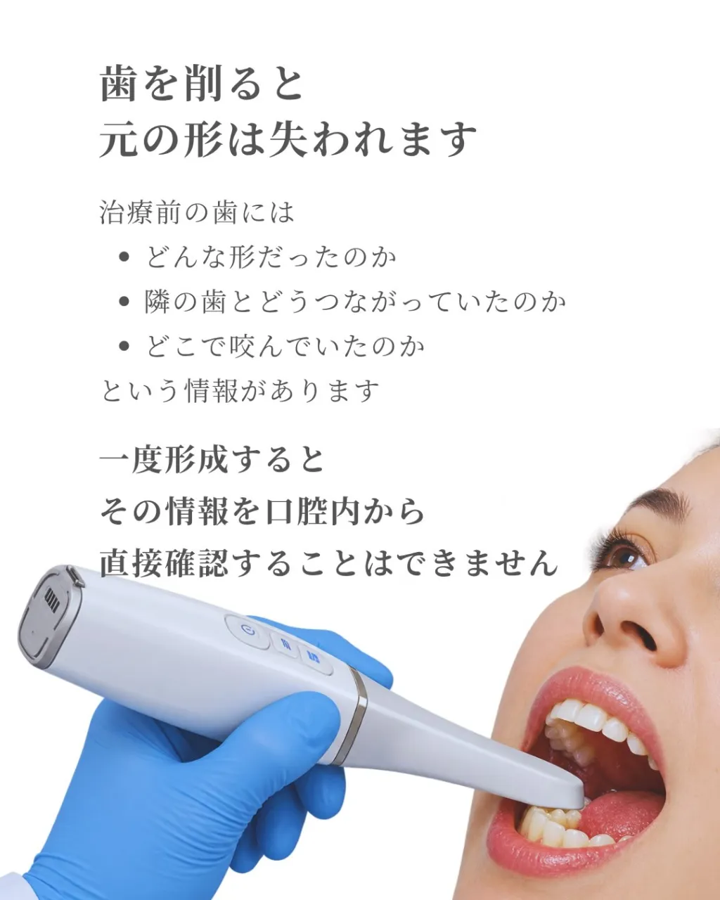🦷【セラミック治療は「削る前」から始まります】