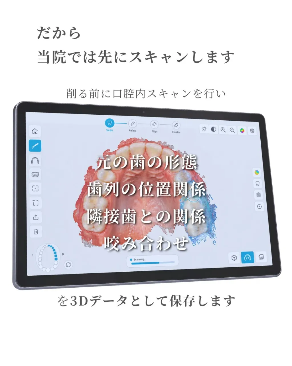 🦷【セラミック治療は「削る前」から始まります】