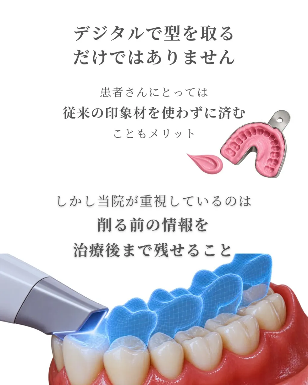 🦷【セラミック治療は「削る前」から始まります】